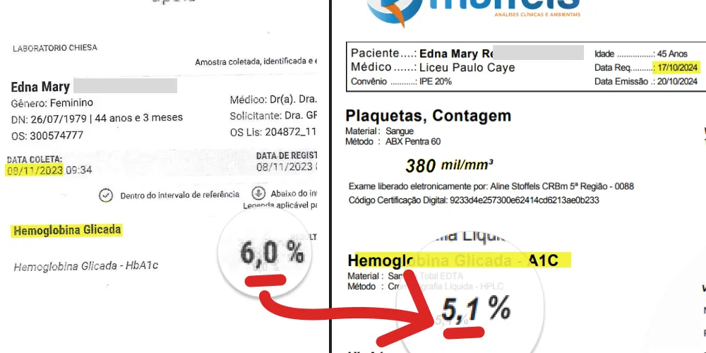 imagem de resultado de glicosímetro